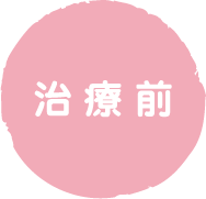 治療前